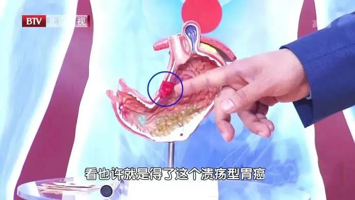 刘耀文胃疼捂胃文图片