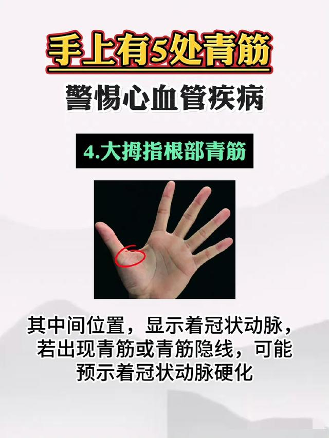 手上五处青筋,需留心