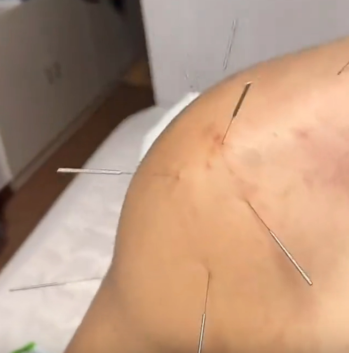 新疆g3赛前4人受伤!阿不都 威金顿出战存疑,黄荣奇带伤影响状态