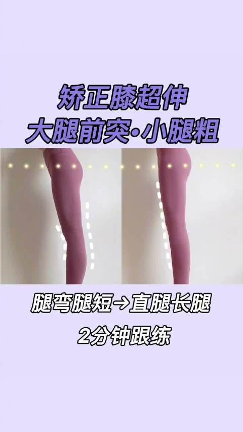 大腿前突小腿粗,原来是膝超伸惹的祸,膝超伸,每走一步路,都是在错误