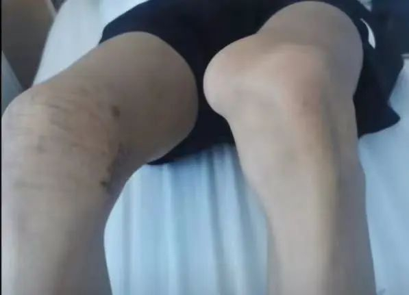 患者术后情况。