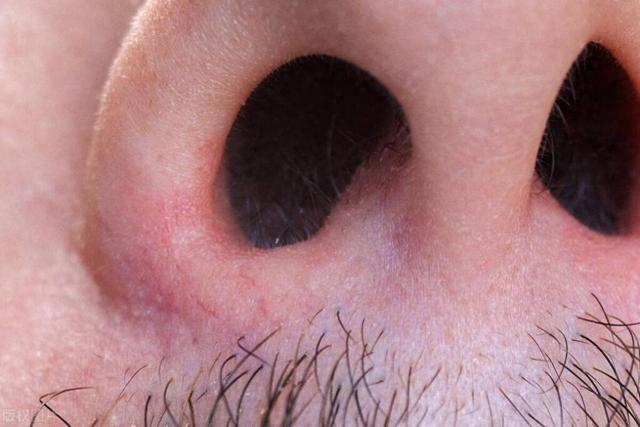 鼻毛长了能拔掉吗?