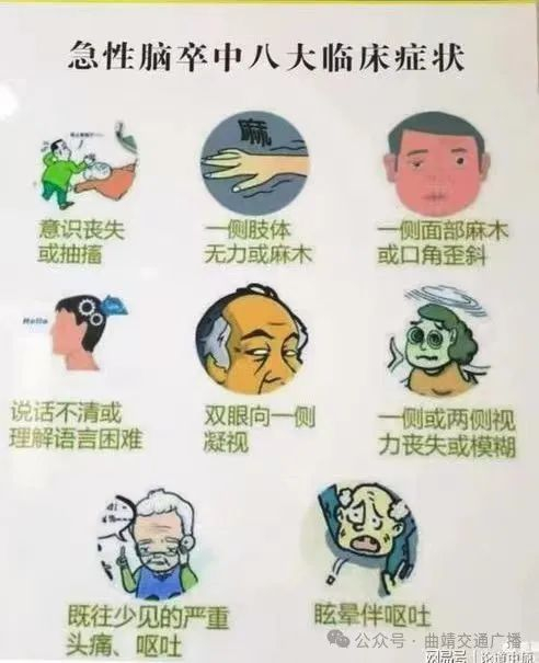 四,脑卒中的症状高血压,糖尿病,高血脂,高同型半胱氨酸血症,冠心病