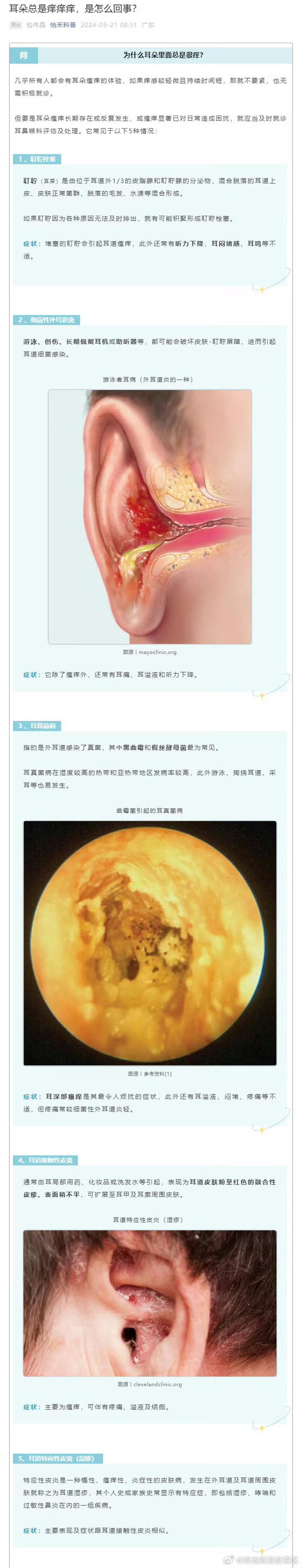 耳朵痒是什么原因图片