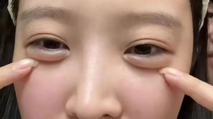 她这88斤的体重里,得有8斤是卧蚕吧?