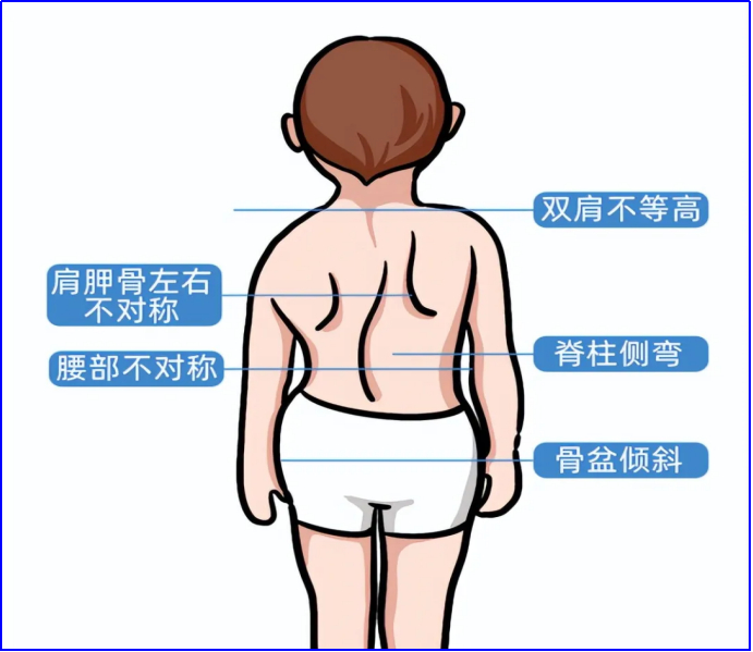 义诊预告丨关注少年儿童脊柱健康 || 897扩散