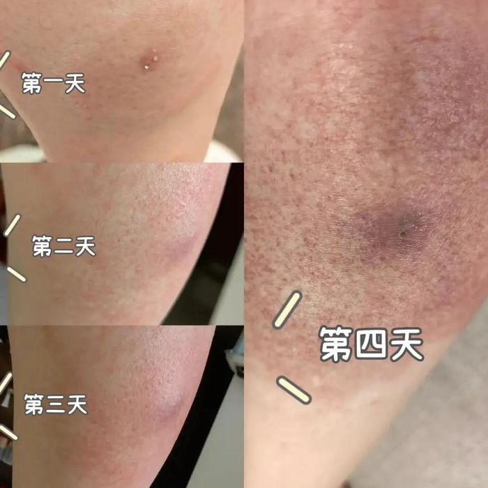 红火蚁|蚁巢|蚁后_新浪新闻