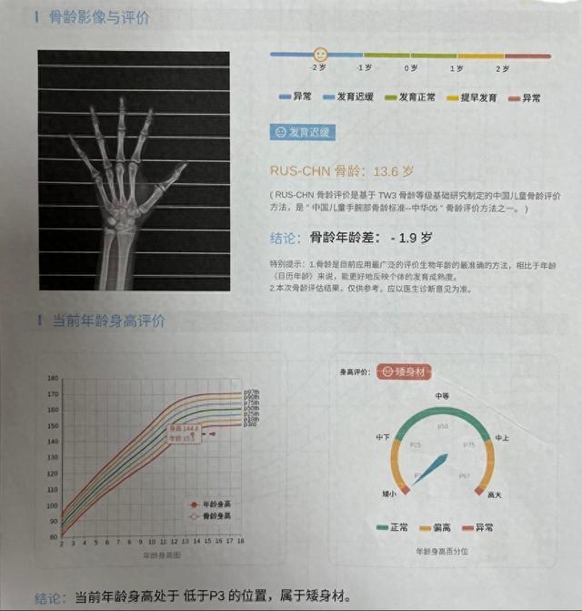 骨骺线闭合网上预约挂号(骨骺线有没有闭合花钱去查多少钱)