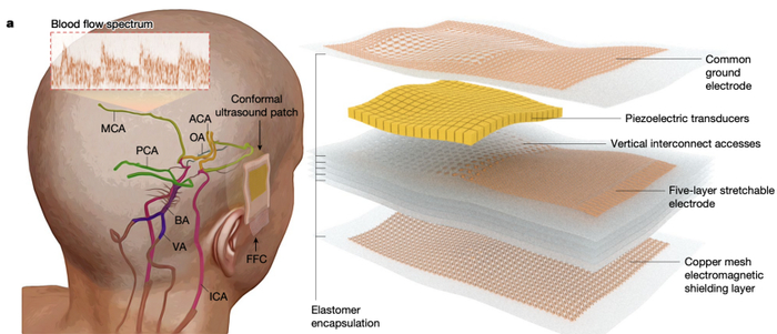 加州大学团队开发新型超声贴片,实现3d脑血流动力学监测,为脑科学研究