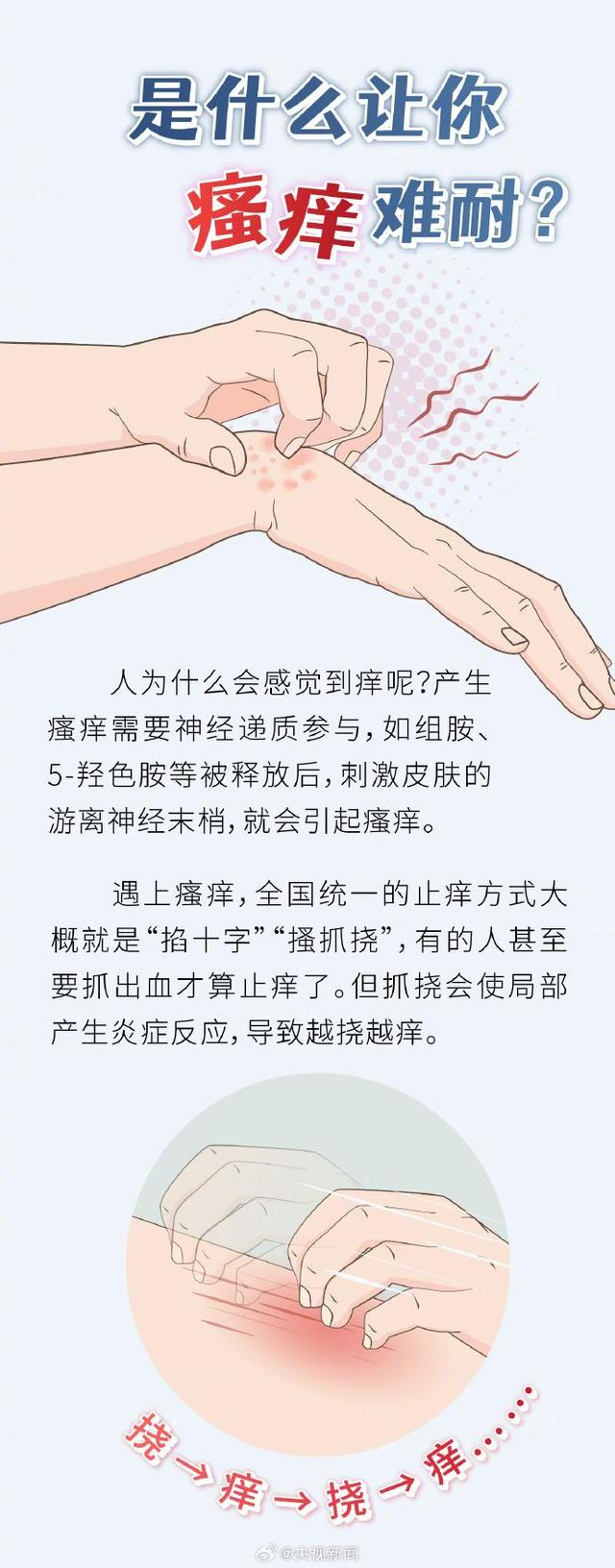 注意!有一种"痒"会传染