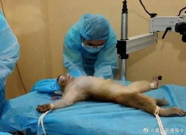 猴子换头手术图片