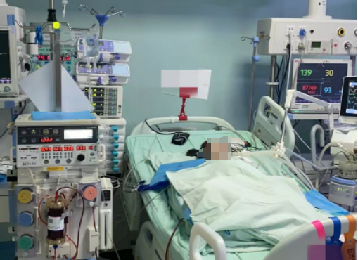 患儿接受连续血液净化治疗之前在家里,小希独自玩耍时突然倒地昏迷并