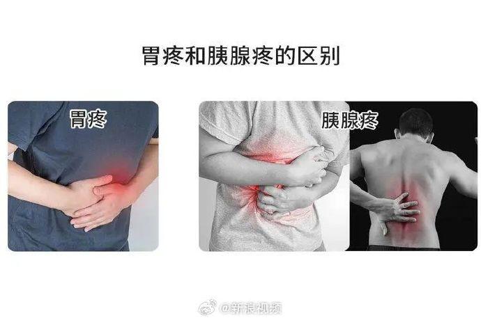 出现5种异常需警惕胰腺癌