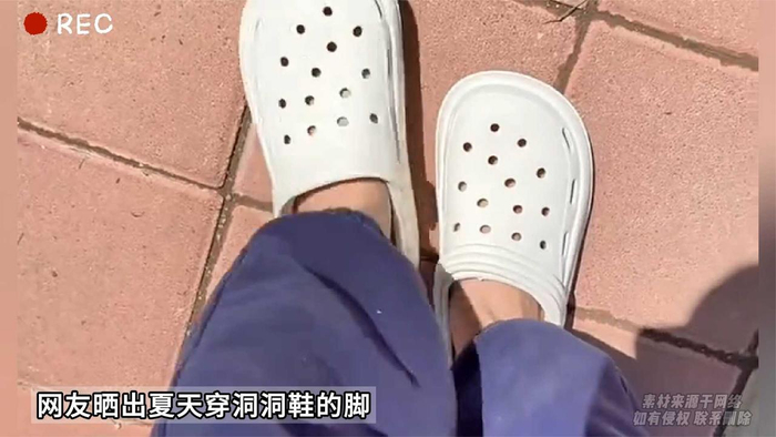 网友晒出夏天穿洞洞鞋的脚