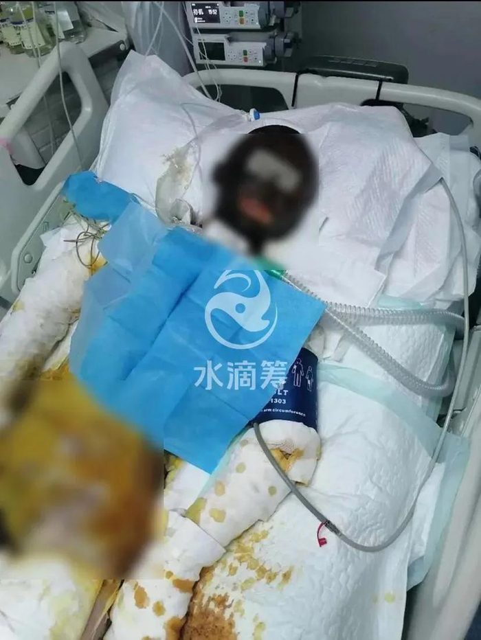 懂爱 | 被老公家暴16次,被打到终身挂粪袋还离不了婚,是谁的锅?