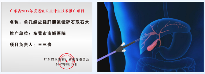 “单孔经皮经肝胆道镜碎石取石术”被评为广东省2017年度适宜卫生计生技术推广项目，图/受访者