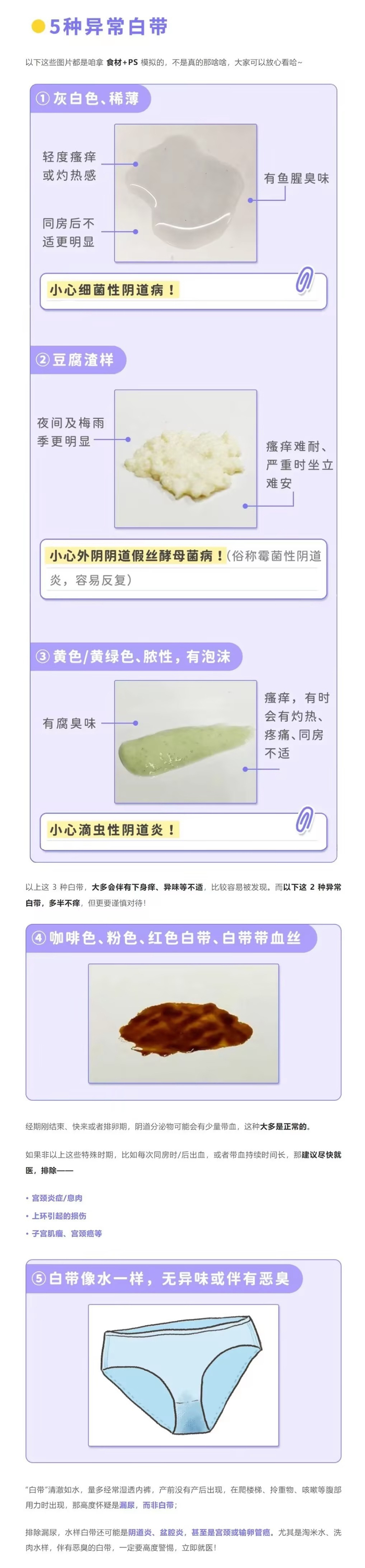 但如果还伴随明显瘙痒,颜色异常的话,可以对照下图大致判断下,非孕期