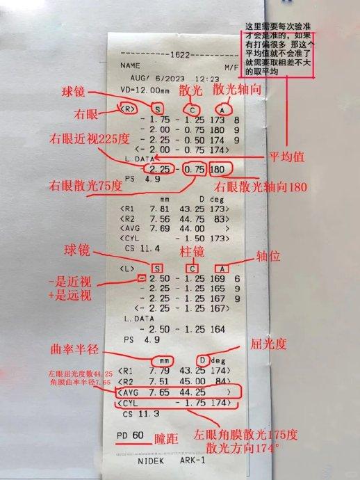 散光度数参考值图片