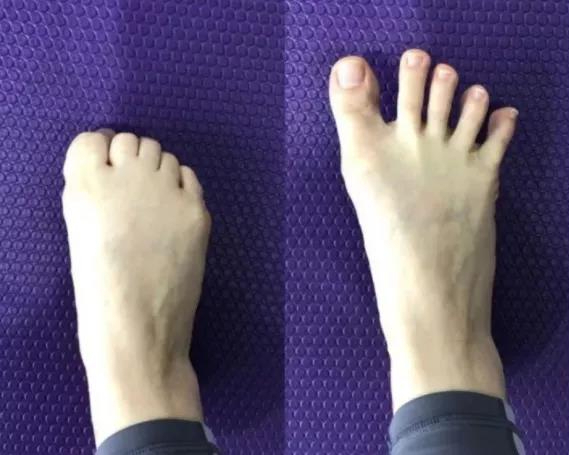 陆毅女儿被质疑营养不良!腿细成麻杆.这是真人的腿?