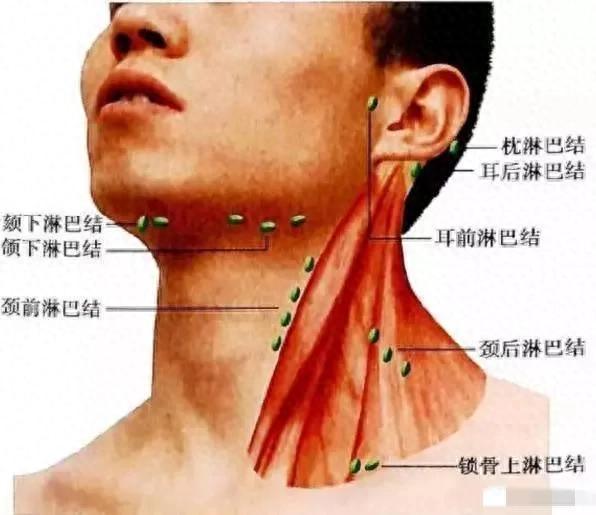 老中医治疗淋巴结肿大