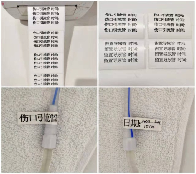 引流管怎么标识5个护理小创新,提升服务大品质_新闻资讯_第4张_活检穿刺产品网 引流管怎么标识5个护理小创新,提升服务大品质_https://www.jmylbn.com_新闻资讯_第4张