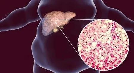 图片来源：123RF