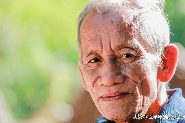 寿命短的人,一般会有4个特征|黄疸|贫血_新浪新闻