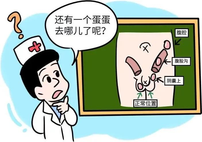 首先,腹腔内的高温环境会影响睾丸的正常生理功能,进而影响精子的生成