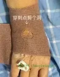 留置针引发新案件,护士你还敢这样做吗?|护士|血管|针头_新浪新闻