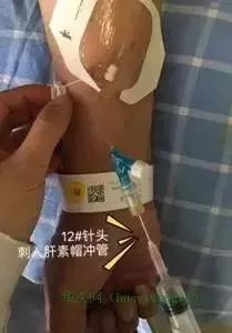 为什么国外不用y型留置针价格留置针引发新案件，护士你还敢这样做吗？_https://www.jmylbn.com_新闻资讯_第7张