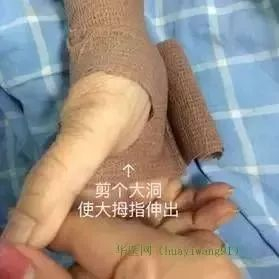 为什么国外不用y型留置针价格留置针引发新案件,护士你还敢这样做吗?_新闻资讯_第3张_活检穿刺产品网 为什么国外不用y型留置针价格留置针引发新案件,护士你还敢这样做吗?_https://www.jmylbn.com_新闻资讯_第3张