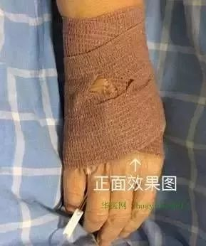为什么国外不用y型留置针价格留置针引发新案件,护士你还敢这样做吗?_新闻资讯_第4张_活检穿刺产品网 为什么国外不用y型留置针价格留置针引发新案件,护士你还敢这样做吗?_https://www.jmylbn.com_新闻资讯_第4张