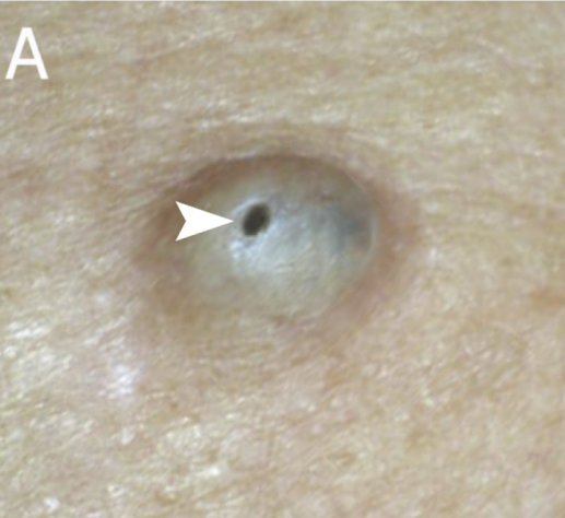 图片来源：参考文献