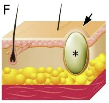 图片来源：参考文献