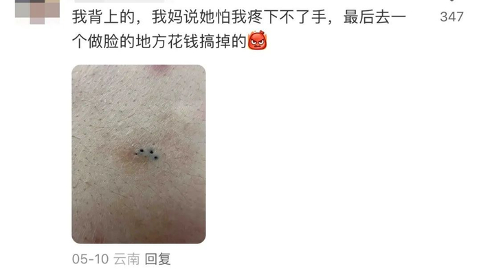 图片来源：小🍠网友评论