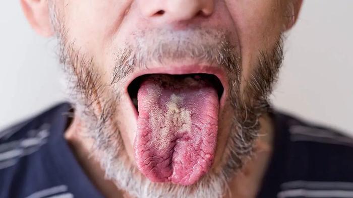 心脏不好的人,一般舌头会有4种异常,要警惕!