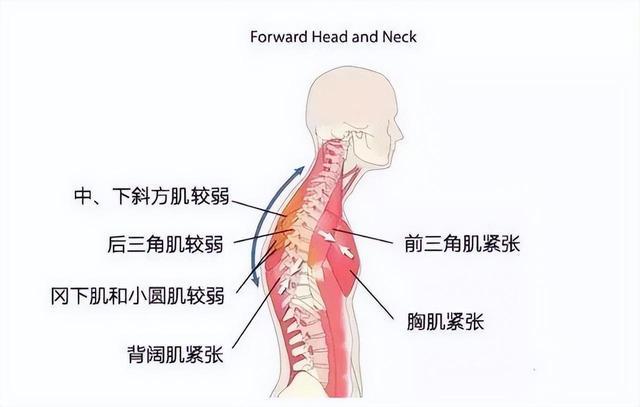 教你5个经典练背动作