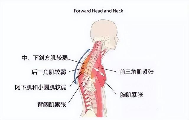 练胸不练背,迟早要残废!教你5个经典练背动作