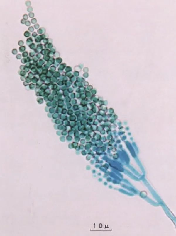 桔青霉（Penicillium citrinum）。图源/Nature Medicine