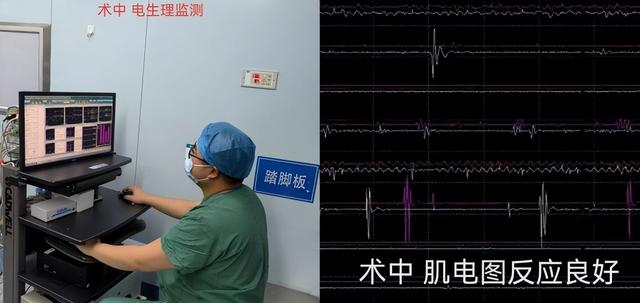 脊髓电刺激技术,为"植物人"带来苏醒希望|神经外科|手术|苏醒_新浪