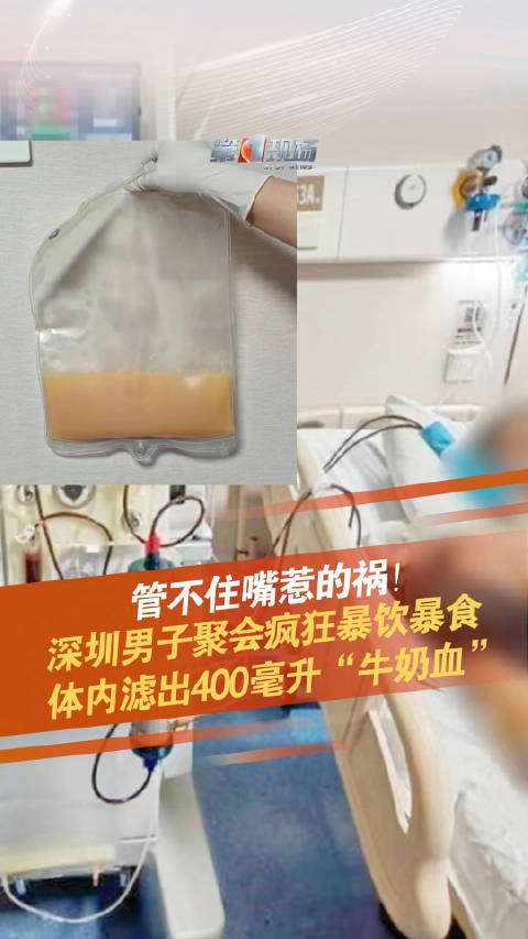 管不住嘴惹的祸!男子暴饮暴食体内滤出400毫升牛奶血