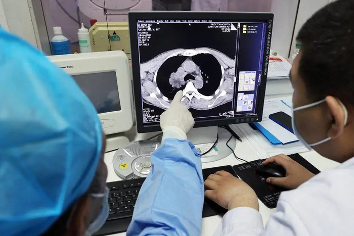 医生在看肿瘤消融术的效果