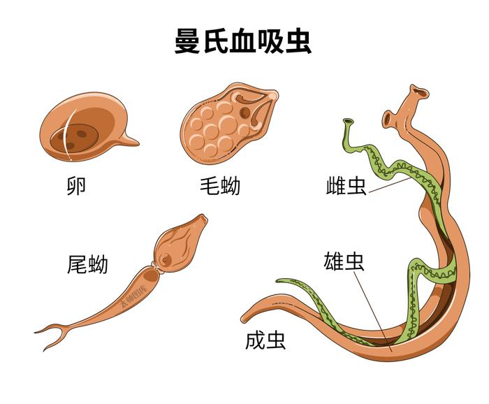 裂头蚴在人体12年图片