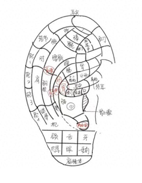 耳轮上有坑图解图片