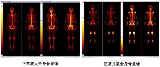 全身ct照片套路图片