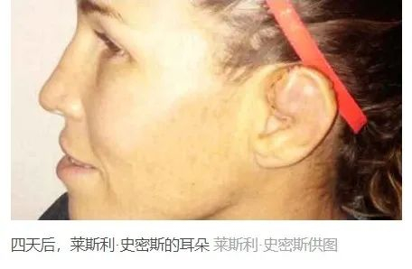 菜花长耳朵上的人,惹不起你躲得起