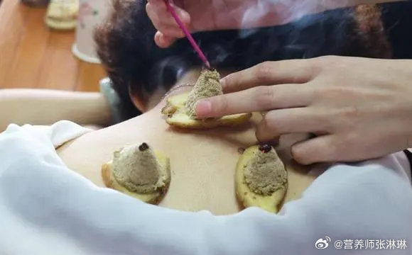 三伏灸的好处