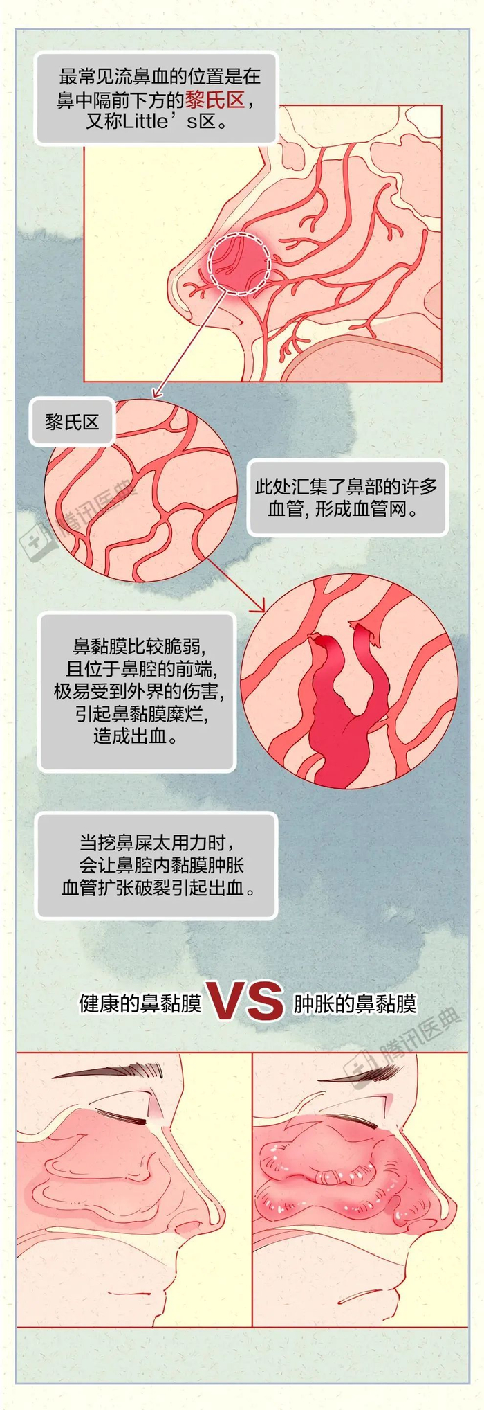 经常挖鼻屎的4个坏处,看完你还敢挖吗?