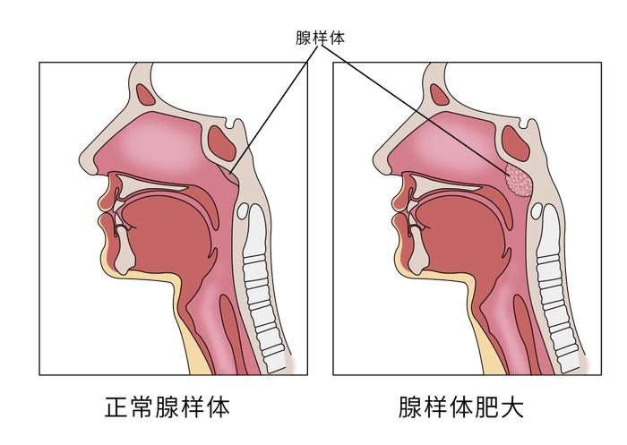 正常的鼻咽部平面图片图片