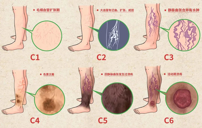 可以参考这张图。图源：网络